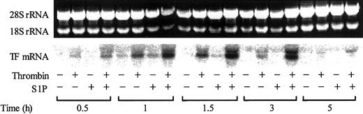 Figure 5. S1P enhances thrombin-induced TF mRNA expression. Confluent monolayers of ECs were treated with or without 2.5 nM thrombin, 4 μM S1P, or 2.5 nM thrombin plus 4 μM S1P for 0.5 to 5 hours. The cells were then harvested and processed for detection of TF mRNA by Northern blot analysis. The upper panel shows the total RNA samples as detected by ethidium bromide staining; intact 18S and 28S rRNA bands served as control of equal RNA loading for Northern blot analysis. The results shown are representative of 3 independent experiments.