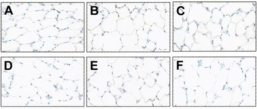 Figure 10. No apoptotic activity in the lungs of the immunized mice by the immunostaining for active caspase-3 and by TUNEL staining. Mice without tumor were immunized, and active caspase-3 was determined by staining the section of the lungs with an antibody reactive to mouse active caspase-3 (A-C), as described in “Materials and methods.” Apoptotic cells in the lungs of the mice were also estimated with TUNEL assay (D-F). No apoptotic activity was found by immunostaining active caspase-3 or by TUNEL staining. (A,D) Immunization with qVEGFR. (B,E) Immunization with mVEGFR. (C,F) Nonimmunization. In addition, qVEGFR-immunized mice (A,D) did not show the alveolar enlargement compared with control groups. Original magnification is ×200 for all panels.