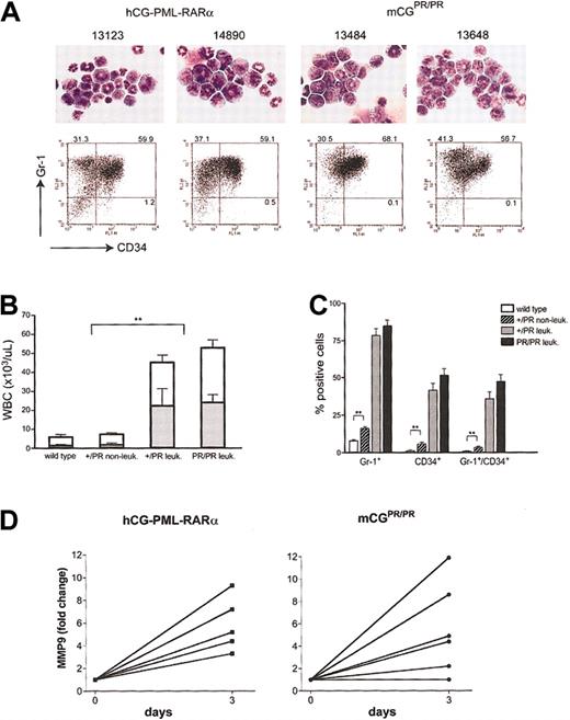 Figure 3. Characterization of APL cells. (A) Morphology by May-Grünwald-Giemsa staining and flow cytometric analysis for Gr-1 and CD34 is shown for 2 independent splenic tumors arising in hCG–-PML-RARα animals and in 2 mCGPR/PR animals. Numbers represent the percentage of cells in each quadrant. Original magnification, ×400. (B) Peripheral white blood cell (WBC; □) counts and absolute neutrophil counts (ANCs; ▦) determined by automated counting are shown for wild-type littermates, nonleukemic mCG+/PR, and leukemic mCG+/PR and mCGPR/PR animals. For panels B and C, wild type = 7 mice; nonleukemic mCG+/PR = 9 mice; leukemic mCG+/PR = 9 mice; leukemic mCGPR/PR = 10 mice. (C) The fraction of Gr-1+, CD34+, and Gr-1+/CD34+ cells in the spleens of wild-type, nonleukemic, and leukemia cells from mCG+/PR (+/–) and mCGPR/PR (+/+) knock-in animals are shown. Error bars indicate ± SEM. (D) The relative increase in abundance of MMP9 mRNA in individual APL samples after 3 days of treatment with 1 μM ATRA relative to diluent alone is shown. Left panel: 5 independent hCG–PML-RARα tumors; right panel: 6 independent mCGPR/PR tumors. MMP9 is normally expressed at its highest levels in terminally differentiated myeloid cells. Expression levels from each sample were normalized by measuring the abundance of GAPDH mRNA, which is expressed at all stages of myeloid development. Pairwise comparisons that yielded statistical significance of P < .01 are indicated by asterisks (**).