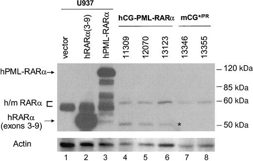 Figure 5. Expression of PML-RARα protein in leukemic spleen cells. Western blots were performed for RARα and actin on transiently transfected U937 cells (harvested 4 hours after transfection) and on independent tumors from each model. Lane 1 represents U937 cells electroporated with an empty expression plasmid; lane 2, U937 cells expressing the RARα portion of human PML-RARα (RARα exons 3-9); and lane 3, U937 cells expressing full-length human PML-RARα (importantly, high-level expression of PML-RARα in these cells is highly toxic, causing the death of most U937 cells within 24 hours of transfection27). Lanes 4-6 represent hCG-PR tumors; lanes 7-8, mCG+/PR (ΔPGK-neo) tumors. The positions of RARα (∼55 kDa) and full-length PML-RARα (∼120 kDa) are marked. A band of approximately 50 kDa marked * represents an unknown protein recognized by the RARα antibody in hCG–PML-RARα tumors. It could potentially represent an altered PML-RARα protein.