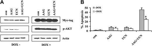 Figure 9. Extent of apoptosis after exposure to doxycycline. (A) Jurkat cells inducibly expressing a constitutively active (myristolated), c-Myc–tagged Akt vector under the control of a tetracycline-responsive promoter were exposed for 48 hours to 5 μM 17-AAG with or without 200 nM UCN-01 in the presence or absence of 2 μg/mL doxycycline. At the end of the incubation period, cell pellets were obtained, the cells lysed, and proteins separated by SDS-PAGE as described in “Materials and methods.” Western analysis was used to monitor expression of the c-Myc tag and phospho-Akt. For each condition, lanes were loaded with 25 μg protein; blots were subsequently stripped and reprobed with antibodies to actin to ensure equivalent loading and transfer. The results of a representative experiment are shown; an additional study yielded equivalent results. (B) Following exposure to 17-AAG with or without UCN-01 for 48 hours in the presence or absence of doxycycline, the percentage of apoptotic cells was determined by morphologic assessment of Wright-Giemsa–stained cytospin preparations as described in “Materials and methods.” Values represent the means ± SDs for 3 separate experiments performed in triplicate. *Significantly less than values obtained for cells exposed to UCN-01 plus 17-AAG in the absence of doxycycline; P < .02.