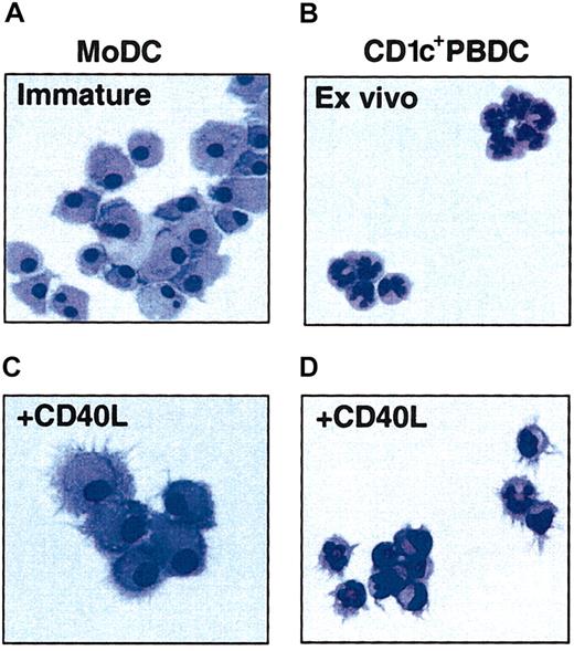 Figure 1. Morphology of immature and mature MoDCs and CD1c+ PBDCs. PBDCs were purified by negative depletion from the peripheral blood of patients treated with FL for 14 consecutive days and then FACS sorted to high purity (greater than 95%) on the basis of CD1c and HLA-DR expression. Autologous MoDCs were generated from blood taken prior to FL administration and cultured for 7 days prior to the parallel isolation of PBDCs. MoDCs were prepared by culturing purified CD14+ monocytes for 7 days in GM-CSF and IL-4. (A) Immature MoDCs. (B) Freshly sorted CD1c+ PBDCs. (C) MoDCs stimulated (second day) with CD40L. (D) CD1c+ PBDCs stimulated (second day) with CD40L. Figures are representative of more than 10 experiments. All photomicrographs are × 100 original magnification.
