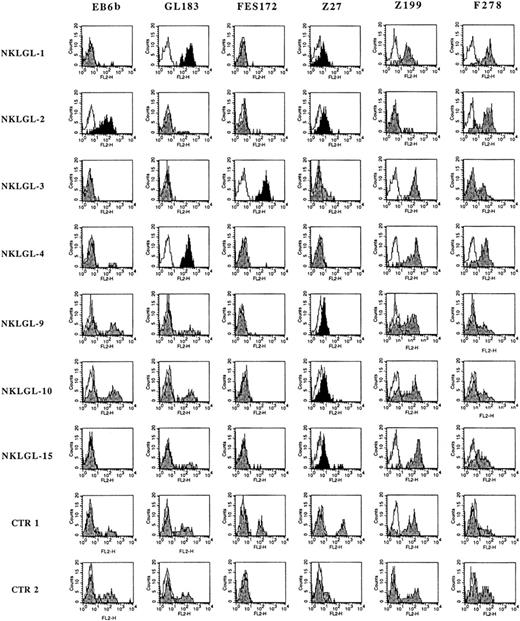 Figure 1. Surface expression of HLA-specific NK receptors in polyclonal NK cell lines from LDGL patients. Polyclonal NK cell lines (NKLGL) derived from 7 LDGL patients and from 2 controls were stained with the indicated mAb specific for different NKRs. In particular, EB6b mAb reacts with KIR2DL1 and S1, GL183 mAb reacts with KIR2DL2/3 and S1, FES172 mAb reacts with KIR2DS4, Z27 mAb reacts with KIR3DL1, Z199 mAb reacts with NKG2A, and F278 mAb reacts with LIR1/ILT2. Open profiles indicate the isotype controls, and gray profiles refer to the specific fluorescence with the above mAbs, whereas black profiles bring into evidence the homogeneous reactivity of given anti-KIR mAb with the whole NK cell population.