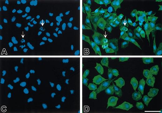Figure 2. FVIIa prevents nuclei condensation in growth factor–deprived BHK(+TF) cells. Monolayers of BHK(+TF) cells were incubated in SFM for 6 hours (A-B) or treated with 20 nM FVIIa in SFM (C-D). At the end of the incubation, the cells were washed, fixed, permeabilized, and stained with Hoechst (A,C) or with goat anti–human TF IgG, followed by biotinylated donkey anti–goat IgG, HRP-streptavidin, and TSA-FITCH (B,D). Note the apoptotic cells (arrows) when BHK(+TF) cells were deprived of serum (A-B) compared with the inhibition of apoptosis seen by the absence of any apoptotic nuclei when treated with FVIIa (C,D). All fields are representative of multiple fields observed in 3 independent experiments. Scale bar indicates 50 μm.