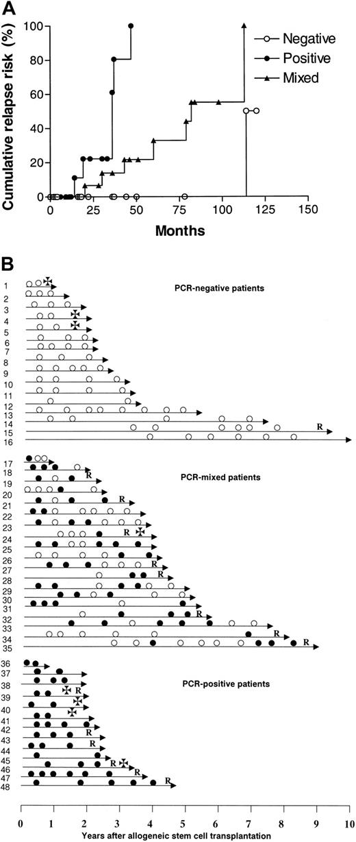 Figure 1. Molecular monitoring of residual myeloma cells after allogeneic stem cell transplantation. (A) Cumulative relapse risk according to molecular status. ○ represents PCR-negative patients; ×, PCR-mixed patients; and •, PCR-positive patients. (B) Molecular follow-up. Unique patient numbers are on the left. • indicates PCR-positive; ○, PCR-negative; R, relapse; and ✠, death.