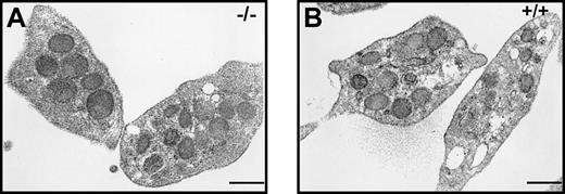Figure 2. Electron microscopy analysis of cellubrevin/VAMP-3 null platelets. Platelets were prepared, maintained as resting, and fixed for electron microscopy as described in “Materials and methods.” (A) Null (–/–) platelets. (B) Wild-type (+/+) platelets. Scale bars equal 0.5 μm.