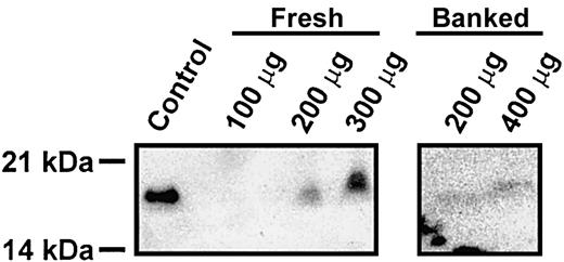 Figure 7. Synaptobrevin/VAMP-2 is present in human platelets. Human platelets were prepared from freshly drawn blood or from banked units and solubilized with 1 × SDS-PAGE buffer containing 2 × Roche Complete EDTA-free protease inhibitor, 2 mM EDTA, 2 mM EGTA, 300 μM calpeptin, 100 μM caspase 3 inhibitor, and 100 μM cathepsin inhibitor. Samples were then heated to 42°C for 20 minutes, and the indicated amounts of total proteins were analyzed by electrophoresis and Western blotting. As a blotting control, 1 μg mouse cerebrum was used.
