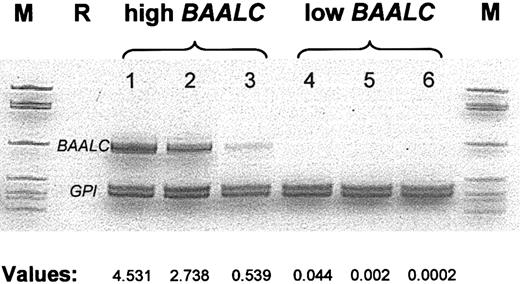 Figure 1. BAALC mRNA expression in pretreatment AML samples as determined by comparative RT-PCR and real-time RT-PCR.The gel illustrates the comparative RT-PCR. The values shown below (expressed as 2μ(ΔCT); see “Patients and methods”) are from real-time RT-PCR experiments on samples from the same individuals. AML samples 1 to 3 represent cases with high level of BAALC transcripts. Samples 4 to 6 represent AML cases from the low BAALC group. M indicates size marker; R, reagent control.