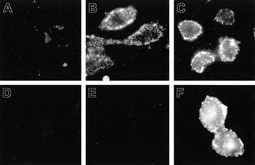 Figure 1. Detection of Nramp1HA and Nramp2HA proteins by immunofluorescence in nonpermeabilized cells. Mouse Nramp1 and Nramp2 cDNAs were modified by in-frame insertion of a hemagglutinin (HA) epitope (YPYDVPDYAS) into the predicted loop delineated by putative TM7 and TM8 followed by transfection into CHO cells. Surface expression was monitored by immunofluorescent detection of the HA epitope in nonpermeabilized cells with the mouse monoclonal anti–HA antibody 16B12. Control CHO cells (A), Nramp2HA-expressing CHO cell line N2-310a (C), and Nramp1HA-expressing CHO cell line N1-1816 (B,D,E,F) were grown on glass coverslips and incubated (1 hour, 4°C) with mouse anti–HA monoclonal primary antibodies (A-C; 1/50 dilution), affinity-purified rabbit polyclonal anti–Nramp1NT antibodies (E; diluted 1/50), or without primary antibody (D). Cells were then fixed, and incubated with goat anti–mouse-IgG-Cy3 (A-D; 1/200) or goat anti–rabbit IgG-rhodamine (E-F; 1/100) secondary antibodies. In panel F, N1-1816 cells were fixed with 4% paraformaldehyde and then permeabilized with 0.5% Triton X-100 prior to addition of primary antibodies to detect both intracellular and PM-localized Nramp1HA protein. Original magnification, × 600 for all panels.