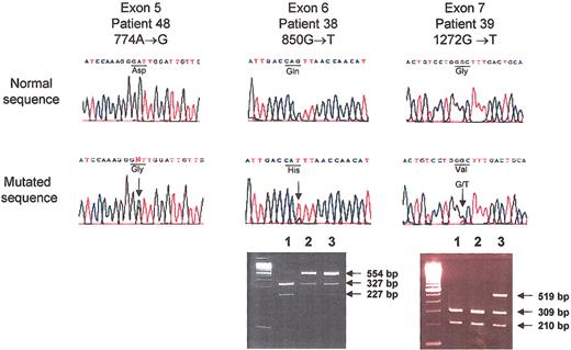 Figure 2. Identification of 3 new ferroportin mutations. For each mutation, a sequence chromatogram of the region of interest is shown for a healthy individual and for the patient, with the healthy and the mutated amino acid. Identification of the patient, the exon containing the mutation, and the mutated nucleotide is given above the panels. Nucleotide numbers are according to the human ferroportin cDNA sequence (GenBank accession no. AF226614). Presence of the mutation was confirmed by restriction site analysis of PCR fragment of the corresponding exon in 2 cases. The 554-bp PCR fragment of exon 6 is cleaved by HincII in normal DNA (lane 1, left gel), whereas the mutation present at the heterozygous state destroys the cleavage site in the DNA of patient 38 (lane 2) and of his daughter (lane 3). The 519 PCR fragment of exon 7 is cleaved by MwoI in control DNA (lanes 1-2, right gel) but not in the mutated DNA (lane 3).