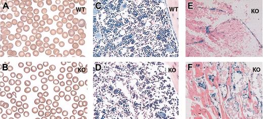 Figure 2. Histologic studies. Blood smear from a 1-month-old wild-type (A) or EPAS1/HIF-2α null (B) mouse. Bone marrow sample preparations from a 1-month-old wild-type (C) or EPAS1/HIF-2α null (D-F) mouse stained with Giemsa stain (C-D) or assayed for β-galactosidase activity (E-F). The samples stained for β-galactosidase activity demonstrate examples of positively stained vascular endothelial cells (E), bone-lining cells (F), and possibly other adventitial cells (E-F). WT indicates wild-type; and KO, EPAS1/HIF-2α null. Original magnifications, × 100 (A-B) and × 20 (C-F).