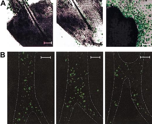 Figure 4. Intrafollicular emergence of bone marrow–derived leukocytes. (A) Vibrissal follicles isolated from the chimeric mice reconstituted with EGFP+ bone marrow cells were cultured for 3 weeks in the presence of 5 added growth factors and examined under confocal microscopy. The displayed images represent multiple clusters of EGFP+ cells detected in 2 different planes within the same HF sample (left and middle panels) and extrafollicular expansion of EGFP+ cells on the top of EGFP– fibroblasts observed on the plane corresponding to the surface of culture plates (right panel). (B) Vibrissal follicles freshly isolated from the chimeric mice reconstituted with EGFP+ bone marrow cells were examined under confocal microscopy. The images show 3 vertical planes (with the follicular papilla side at the bottom) of a representative HF sample scanned sequentially with 5 μm distance between planes. The ORS regions delineated by their faint autofluorescence signals are outlined by dotted lines. Data shown are representative of 3 (A) or 2 (B) independent experiments. Scale bars represent 50 μm (A) or 100 μm (B).