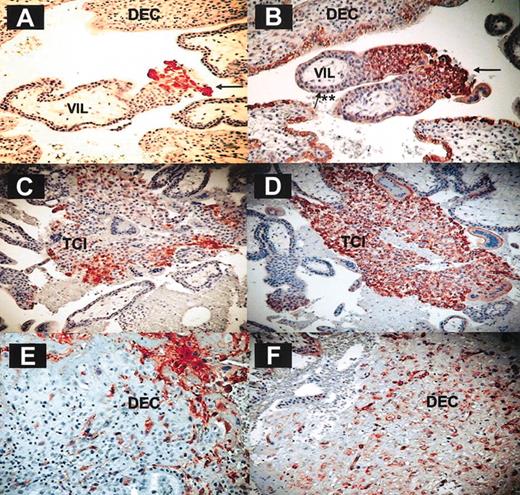 Figure 6. CXCL12 is expressed on invasive fetal trophoblasts. Immunohistochemistry on paraformaldehyde-fixed decidual tissue (9 weeks). Immunohistochemistry was performed on first-trimester serial sections derived from placental and decidual tissues. The figure shows HLA-G (left column) and CXCL12 (right column) staining on intermediate trophoblasts (A-B), trophoblast cell islands (C-D), and invasive EVTs (E-F) derived from first-trimester deciduae. One representative staining experiment is shown of 9 performed. Arrows indicate fetal trophoblasts; **, villous cytotrophoblasts and syncytiotrophoblasts; DEC, decidua; VIL, villous; and TCI, trophoblast cell island. Magnification is × 200 for all panels.