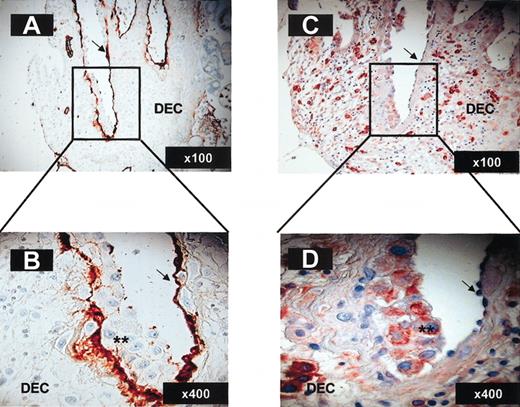 Figure 7. Invasive trophoblasts lining maternal decidual blood vessels express CXCL12. Immunohistochemistry on paraformaldehyde-fixed serial decidua tissue sections (12 weeks; 6 μ). Staining with anti–von Willebrand factor polyclonal antibody (A-B) and CXCL12 (C-D) of decidual blood vessels undergoing endovascular invasion by trophoblasts. Arrows indicate endothelial cells; **, invasive trophoblasts. The magnification for each panel is indicated in the lower right corner.