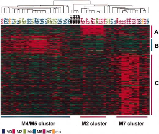 Figure 4. Clustering of patients based on the expression data of the 213 FAB subtype-specific genes. Each column represents a patient, and each row represents a gene. Patient numbers are colored according to their FAB subtypes. M2-, M4/M5-, and M7-specific genes are indicated by red (A), green (B), and purple (C) vertical bars, respectively. M2, M4/M5, and M7 clusters of patients are indicated by red, green, and purple horizontal bars, respectively.