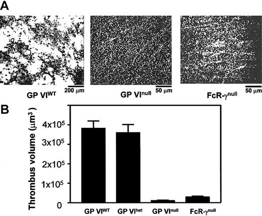 Figure 5. In vitro thrombus formation on surface-bound collagen. Blood was collected from anesthetized mice via a retro-orbital puncture using 40 U/mL heparin as anticoagulant. Apyrase was added to a final concentration of 1.5 U/mL. Glass coverslips were coated with insoluble fibrillar type I collagen (2.5 mg/mL) and placed in a parallel plate flow chamber. Mouse blood was treated with mepacrine for platelet visualization and perfused through the chamber at 1500/second wall shear rate. (A) Single frames taken from a continuous recording show the collagen-coated surface after 2.5 minutes of blood perfusion. In the left panel, thrombi formed by normal platelets are seen at a relatively low magnification (original magnification, × 10). The center and right panels show the surfaces exposed to GP VInull and FcR-γnull platelets, respectively, at a relatively higher magnification (original magnification, × 40); in either case, a complete surface coverage by single platelets is apparent, with formation of small clusters particularly in the case of FcR-γnull platelets but absence of thrombus formation. See Video 1 for a clearer representation of these results. (B) Postperfusion thrombus volume was determined from serial z-sections. The results presented are the mean from 3 independent experiments.