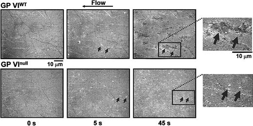 Figure 6. Time course analysis of the contact interface between platelets and collagen fibrils. Blood was obtained as described in the legend to Figure 5, with the exception that no mepacrine was added. The technique of RICM, described in “Materials and methods,” allows visualization of the larger collagen fibrils immobilized on the glass bottom of the flow chamber before the beginning of blood perfusion (time 0 s). After 5 seconds of perfusion with either normal or GP VInull blood, comparable numbers of single platelets (arrows) are seen interacting with the surface. Their shape is round indicating that spreading following activation has not yet taken place. After 45 seconds, in the case of normal blood perfusion the adherent platelets have become spread and occupy a larger portion of the surface; in contrast, in the case of GP VInull blood perfusion, platelets have the same morphology as after 5 seconds, indicating that they have not become activated and, thus, have not spread. The insets to the right present a larger magnification of the surface after 45 seconds of perfusion. Note that the individual boundaries of spread platelets tend to be lost. In this technique, the darker color of spread platelets compared with those that have not spread indicates a closer proximity to the collagen fibrils. Video 2 presents a more detailed view of these events and demonstrates that the spread platelets represent the base of large thrombi attached to the collagen fibrils and protruding into the flow path.