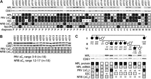 Figure 1. Summary of MPD marker analysis. (A) Cohort of 44 MPD patients. Open squares signify normal findings, black squares indicate abnormal values. Expression of c-MPL protein from platelets was detected by Western blot analysis and compared with CD61 to normalize for platelet protein loading. Unique patient numbers were placed above the corresponding lanes. L indicates decreased expression of c-MPL protein. PRV-1 and NFIB mRNA levels were determined by real-time PCR. Numbers indicate the ΔCT values (see “Study design”). Note that high numeric ΔCT values indicate low or normal abundance of mRNA (open squares), whereas low or negative ΔCT values signify elevated levels of expression (black squares). Presence (+) or absence (–) of EEC or 9pLOH is indicated. nd indicates not determined; P, polycythemia vera; E, essential thrombocythemia; and M, chronic idiopathic myelofibrosis. (B) Healthy controls. (C) Hereditary thrombocythemia. Individuals within the pedigree are placed above the corresponding lanes and are numbered as by Wiestner et al.13 Black symbols indicate affected individuals. Serum TPO concentration in pg/mL (numbers in italic) and platelet count × 109/L (numbers in regular style) are shown below each individual.