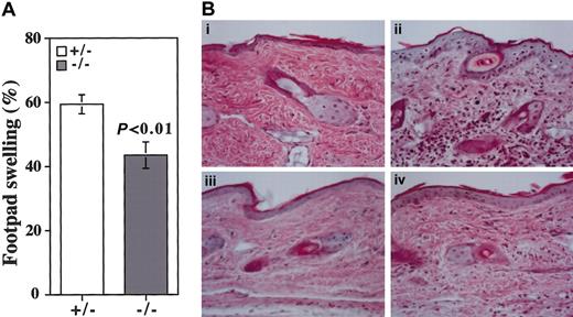 Figure 8. DTH response induced by mBSA. (A) DTH response was induced by mBSA in mBSA-sensitized β4GalT-I+/– (□; n = 8) and β4GalT-I–/– (▦; n = 8) mice. The increase in footpad thickness was calculated as described in “Materials and methods.” (B) Weigert hematoxylin and eosin staining of footpad sections. (i) PBS-injected β4GalT-I+/– mice. (ii) mBSA-injected β4GalT-I+/– mice. (iii) PBS-injected β4GalT-I–/– mice. (iv) mBSA-injected β4GalT-I–/– mice. Original magnification, × 100.