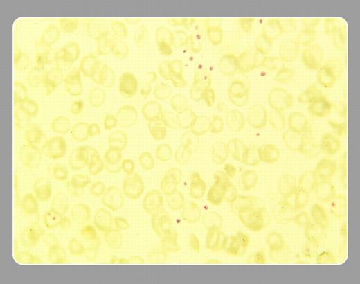 Stanley Schrier, Stanford University School of Medicine