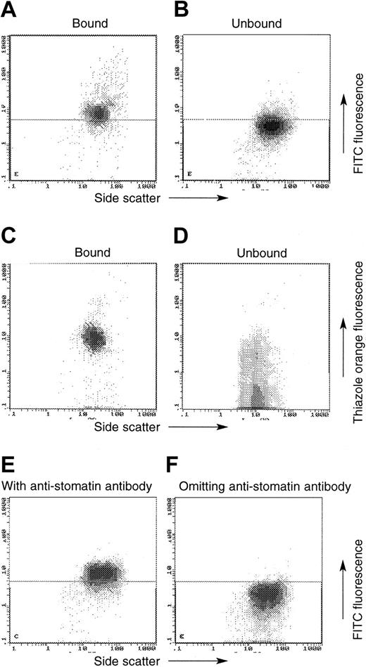 Figure 5. MACS using antitransferrin receptor (TfR) antibody in normal and OHSt cells (patient A-II-1). In these plots, the x-axis always denotes side scatter, whereas the y-axis denotes either the emission of the FITC-labeled swine anti–rabbit IgG (detecting the antistomatin antibody; A-B, E-F) or thiazole orange (C-D). OHSt cells that bound to the anti-TfR beads (A, C) show positive antistomatin antibody immunoreactivity (A) and enhanced thiazole orange staining (C), whereas unbound OHSt cells show less antistomatin antibody immunoreactivity (B) and less thiazole orange staining (D). Control experiments shown in panels E-F show the level of FITC emission from normal cells in the presence (E) and absence (F) of the primary antistomatin antibody. These control experiments define the horizontal demarcating boundary between “stomatin-positive” and “stomatin-negative” cells seen in panels A-B.
