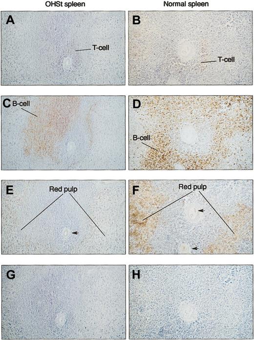 Figure 7. Immunocytochemistry of spleen. Serial sections were prepared and stained with anti-CD3 (A-B) and anti-CD20cy (C-D) and antistomatin (E-F) antibodies. Patient (A-II-1) sections are shown in the left column (A,C,E,G) against a normal spleen in the right-hand column (B,D,F,H). T-cell and B-cell areas of the white pulp surrounding a central artery are identified by staining with specific antibodies. In neither normal nor OHSt spleen was stomatin immunoreactivity selectively associated with predominantly T- or B-cell areas of the spleen. In normal spleen (F), the red pulp that is distant from the central artery is strongly stomatin immunoreactive, consistent with the concentrated red cell population, whereas in the patient (E), the equivalent area is less strongly positive. Note the specific stomatin-positive staining of the arterial endothelium in panels E-F (arrows). (G-H) Negative controls for antistomatin antibody (G) and murine monoclonal antibodies (H). Bar represents 10 μm.