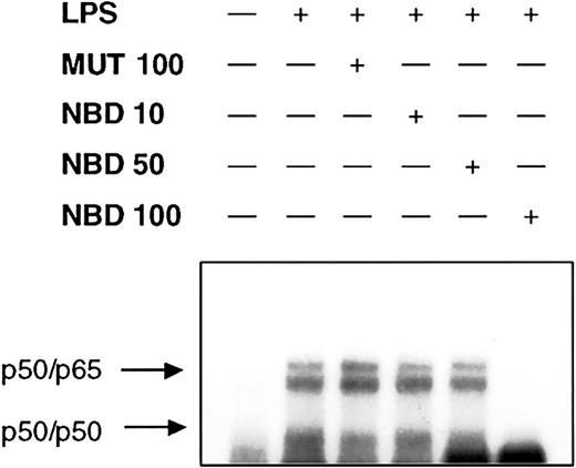 Figure 6. NEMO-binding domain (NBD) peptide abrogates LPS-induced NF-κB mobilization. Cells (2 × 106) were either left untreated or were incubated with control peptide (MUT, 100 μM) or increasing concentrations of NBD (10, 50, and 100 μM) for 60 minutes before treatment with 1 μg/mL LPS for 90 minutes. NF-κB binding activity was assessed by EMSA. Pretreatment with 100 μM TAT-NBD led to the abrogation of LPS-induced NF-κB activity. A representative figure of 3 independent experiments is depicted.
