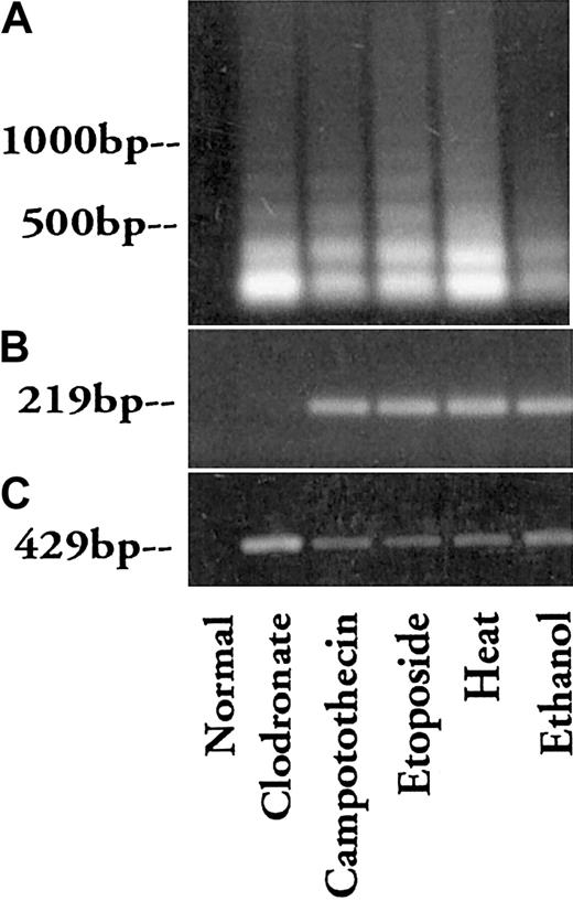 Figure 7. Properties of plasma DNA. Peak plasma DNA levels from various preparations, as indicated, were extracted and analyzed on a 0.8% agarose gel (A). These DNAs were also used as templates in PCR to amplify the Y chromosome (B) and the GAPDH gene (C). Numbers indicate DNA size according to a DNA standard. Results are representative of several experiments.