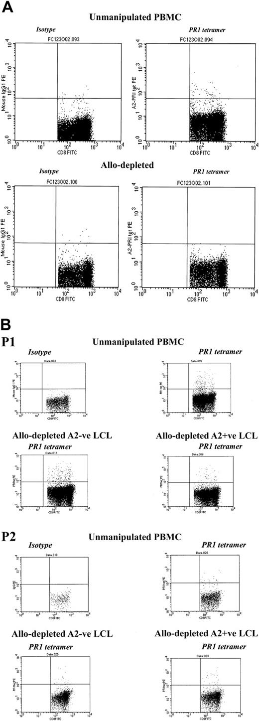 Figure 7. CD8+ T cells specific for the myeloid tumor epitope PR1 are retained after allodepletion after stimulation with mismatched LCLs but not CML PBMCs. (A) FACS analysis following staining with HLA-A2–PR1 tetramer of unmanipulated PBMCs (top row) or allodepleted PBMCs (bottom row) from a patient with CML. In each case isotype controls are shown on the left and tetramer-stained cells on the right. Allodepletion was performed after stimulation with allogeneic HLA-A2–positive PBMCs from a mismatched donor with CML. (B) FACS analysis following staining with HLA-A2–PR1 tetramer of unmanipulated PBMCs or allodepleted T cells from 2 HLA-A2–positive patients with CML. Allodepletion was performed after stimulation with either HLA-A2–positive or –negative LCLs. The percentages of tetramer-positive cells as a proportion of CD8+ cells (isotype subtracted) are shown.