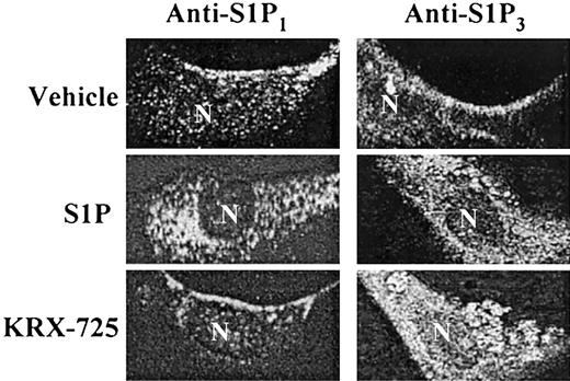 Figure 3. KRX-725-induced internalization of S1P3. HUVECs were grown overnight with 2% c-FCS and incubated with vehicle (0.1% DMSO), S1P (1 μM), and KRX-725 (20 μM) for 45 minutes. Cells were fixed with 4% paraformaldehyde, permeabilized, blocked, and immunostained with anti-EDG1 and EDG3-NT antibodies, followed by Cy3- and FITC-labeled secondary antibodies, respectively. Visualization was done using confocal microscope using × 63 objective.