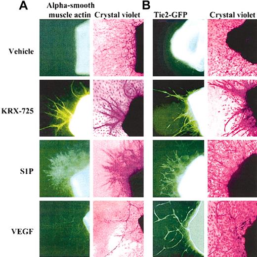 Figure 6. Presence of vascular smooth muscle and endothelial cells in aortic ring sprouts induced by KRX-725, S1P, and VEGF. (A) Involvement of vascular smooth muscle cells in sprouts. Aortic rings of BALB/c mice were incubated with vehicle (0.1% DMSO), KRX-725 (20 μM), S1P (200 nM), and VEGF (20 ng/mL) for 8 days. The rings were then fixed with paraformaldehyde and stained with FITC-conjugated alpha smooth muscle actin antibody (left column), followed by 0.02% crystal violet (right column). (B) Involvement of endothelial cells in sprouts. Aortic rings of FVB/N-TgN(TIE2GFP)287Sato mice were incubated with vehicle (0.1% DMSO), KRX-725 (20 μM), S1P (200 nM), and VEGF (20 ng/mL) for 8 days. Fluorescent micrographs were taken prior to fixation and staining. Fluorescence emanates from expression of green fluorescent protein (GFP) under endothelial-specific promoter (tie-2). Each micrograph is a representative of 9 repeats. Micrographs were taken under × 10 objective.