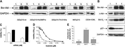 Figure 1. RNAi leads to specific down-regulation of Bcr-Abl protein levels, resulting in a significant reduction of viability and sensitization to imatinib mesylate. (A) Western blot analysis of Bcr-Abl in 32Dp210-wt, 32Dp210-Thr315Ile, 32Dp210-His396Pro, M07p210, and primary CD34+/CML cells after siRNA treatment (800 nM). Lane 1, BAF7, siRNA homologous to bcr-abl b3a2 fusion site; lane 2, BAF8, mismatch siRNA; lane 3, EPC. Glyceraldehyde-3-phosphate dehydrogenase (GAPDH) level served as a loading control. The decrease in Bcr-Abl levels caused by BAF7 treatment was determined by densitometry—83% in 32Dp210-wt, 86.22% in 32Dp210-His396Pro, 71.83% in 32Dp210-Thr315Ile, 93.9% in M07p210, and 74.3% in primary CD34+/CML cells (because of the low expression of Bcr-Abl, a more sensitive technique was applied in primary CD34+ cells). (B) Western blot analysis of Bcr-Abl, c-Abl, Bcl-XL, and p27 in 32Dp210 cells after treatment with siRNA (800 nM), as indicated (lane1, BAF7; lane 2, BAF8; lane 3, EPC). GAPDH level served as a loading control. (C) BAF7 treatment led to a dose-dependent reduction of viability in 32Dp210 cells. Forty hours after the second treatment with 200 nM and 800 nM siRNA, respectively, viability of cells (relative to EPC) was determined by means of MTT (BAF7, white bars; BAF8, black bars). Values are means ± SD of 6 examinations. (D) Treatment with suboptimal amounts of breakpoint-specific siRNA (200 nM) results in sensitization to imatinib mesylate. After siRNA treatment, 32Dp210 cells were exposed to imatinib concentrations ranging from 0.03 μM to 1.0 μM. Cell viability was measured after 40 hours by means of MTT assay. BAF7-treated cells (▴) showed significantly higher sensitivity for imatinib than cells treated with BAF8 (•) or cells electroporated without any siRNA (EPC, □). The IC50 values for imatinib were 0.08 μM (BAF7), 0.27 μM (BAF8), and 0.27 μM (EPC), respectively. Values are means ± SD of triplicates. (E) After siRNA treatment, M07p210 cells were exposed to imatinib at a concentration of 0.05 μM for 21 hours. The percentage of apoptotic cells was then determined by Annexin V–FITC assay. Values are means ± SD of 3 independent experiments.