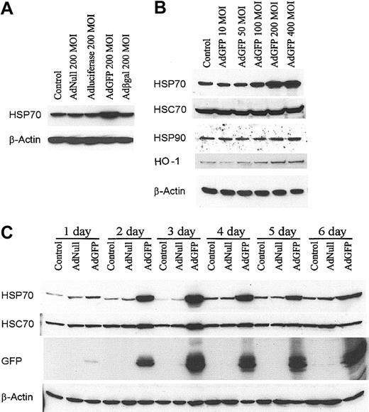Figure 1. GFP Ad vector induced HSP70 protein expression in HUVECs. (A) Cells were treated with culture medium (control), AdNull 200 MOI, AdLuciferase 200 MOI, AdGFP 200 MOI, and Adβ-galactosidase (Adβ-gal) 200 MOI, and cultured in growth factor–free medium for 48 hours. Cellular extracts were prepared from HUVECs, and HSPs were detected by Western blot analysis using antibodies specific for HSP70 and β-actin. (B) HUVECs were infected for 48 hours with control or AdGFP at the indicated concentrations ranging from 50 to 400 MOI. Immunoblots were probed with antibodies specific to HSP70, HSC70, HSP90, HO-1, and β-actin. (C) HUVECs were infected with control, AdNull (200 MOI), or AdGFP (200 MOI) for the indicated time periods. Immunoblots were probed with antibodies specific for HSP70, HSC70, GFP, and β-actin. The results shown represent one sample experiment from a total of 3 independent experiments.