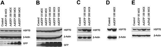 Figure 2. GFP-induced HSP70 protein expression specific in ECs. Non-ECs: HuSMCs (A) orA549 cell line (B) were infected with AdGFP (50-500 MOI) for 48 hours. ECs: HDMECs (C), BMECs (D), or HMVECs (E) were infected with AdGFP or AdNull at the indicated concentrations ranging from 50 to 200 MOI for 48 hours. Cell lysates were then assayed for HSP70, GFP, and β-actin by Western blotting.
