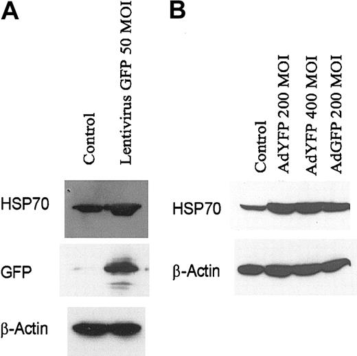 Figure 4. Increased HSP70 expression in HUVECs after engraftment with lentivirus-transduced GFP or AdYFP. (A) HUVECs infected with lentivirus GFP (MOI 50) for 48 hours. (B) HUVECs infected with AdNull (200 MOI), AdYFP (200 MOI), AdYFP (400 MOI), and AdGFP (200 MOI) for 48 hours. Immunoblots were probed with antibody specific for HSP70, GFP, and β-actin.