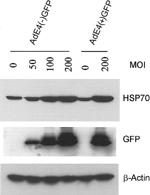 Figure 5. Effect of E4+ GFP Ad vector or E4– GFP Ad vector on HSP70 expression in HUVECs. Confluent ECs infected with the E1–E4– AdGFP or E1–E4+ AdGFP vector, or uninfected controls, were cultured in growth factor–free medium for 48 hours. Immunoblots were probed with antibody specific for HSP70, GFP, and β-actin.