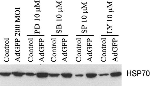 Figure 6. Effects of kinase inhibitors on the HSP70 protein expression in HUVECs. Cells were infected with AdGFP (200 MOI) or uninfected control and cotreated with either PD98059 (PD), SB203580 (SB), SP600125 (SP), or LY294002 (LY) for 48 hours. Cells were harvested and lysed for Western blot analysis of HSP70.