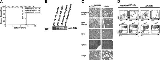 Figure 6. Myeloproliferative disease in mice receiving ΔActin BCR-ABL bone marrow is indistinguishable from wild-type P210BCR-ABL. (A) All lethally irradiated mice receiving transplanted bone marrow expressing either wild-type P210BCR-ABL (○) or ΔActin BCR-ABL (▵) bone marrow showed evidence of disease by 14 days after transplantation. The latency between wild-type P210BCR-ABL and ΔActin mice was not significantly different (P = .38), whereas mice given bone marrow expressing the MigRI control vector (□) are healthy within this interval and remain disease free for more than 300 days.14 (B) Spleens harvested from wild-type P210BCR-ABL or ΔActin mice were lysed and fractionated on a Western blot to show expression of P210BCR-ABL or ΔActin at the appropriate size. 32D cells transduced with either P210BCR-ABL or ΔActin were used as a control. Expression of BCR-ABL could not be detected in spleens of ΔActin mice using an antibody to the extreme C-terminus of BCR-ABL, confirming that the C-terminal actin-binding domain was absent in these mice (data not shown). (C) Sections of peripheral blood (40 ×), bone marrow (20 ×), spleen (4 ×), liver (20 ×), and lung (4 ×) were stained with hematoxylin and eosin or Wright stain (peripheral blood). Mature myeloid cells are present in the peripheral blood, and the normal architecture of each organ is replaced by infiltrative granulocytes. Lungs of the ΔActin mice were less hemorrhagic than of P210BCR-ABL mice. (D) A representative flow cytometry profile of peripheral blood from wild-type P210BCR-ABL and ΔActin mice is shown. Peripheral blood, bone marrow, and spleen from wild-type P210BCR-ABL or ΔActin mice were harvested and stained for the myeloid markers GR-1 and Mac-1. Most cells from each organ of mice from both cohorts stained GR-1+/Mac-1+, indicating infiltrative granulocytic disease.