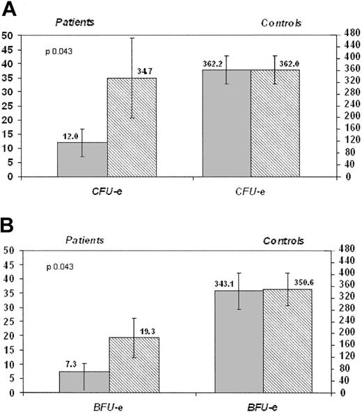 Figure 3. Effect of anti–TNF-α on the growth of erythroid committed progenitors in FA patients and controls. (A) Each column represents mean values; error bars indicate the SE of the estimate. We also reported in brackets median, minimum, and maximum values. In the patients, CFU-Es (mean, 34.7; median, 19.0; minimum, 0; maximum, 100) grown after the addition of LD anti–TNF-α (1 μg/mL) significantly outnumbered (P = .043) that grown in the absence of anti–TNF-α (mean, 12.0; median, 9.0; minimum, 0; maximum, 37; left side). A similar significant difference was obtained with HD anti-TNF-α (10 μg/mL; P =.028; diagram not shown). The addition of anti–TNF-α had no effect on the growth of CFU-Es in healthy controls (mean number of colonies without LD anti–TNF-α, 362.2; median, 353.5; minimum, 102; maximum, 522; mean number of colonies with LD anti–TNF-α, 362.0; median, 349.0; minimum, 96; maximum, 525; right side). (B) Each column represents mean values; error bars indicate the SE of the estimate. We also reported in brackets median, minimum, and maximum values. In the patients, BFU-Es grown after the addition of LD anti–TNF-α (mean, 19.3; median, 12.0; minimum, 0; maximum, 45) significantly outnumbered (P =.043) that grown in the absence of anti–TNF-α (mean, 7.3; median, 6.0; minimum, 0; maximum, 24; left side). The same held true, with the identical significance (P = .043), also for HD anti–TNF-α (diagram not shown). The addition of anti–TNF-α had no effect on the growth of BFU-Es in healthy controls (mean number of colonies without LD anti–TNF-α, 343.1; median, 336.5; minimum, 66; maximum, 691; mean number of colonies with LD anti–TNF-α, 350.6; median, 332.5; minimum, 142; maximum, 695; right side). indicates no anti–TNF-α; ▦ with anti–TNF-α (1 μg/mL).
