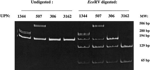 Figure 2. Detection of FLT3 D835 mutations. Undigested and EcoRV-digested PCR products from UPN1344 with a 6-bp deletion of R834 and D835 and UPN507 with D835H mutation and deletion of I836. The upper doublets correspond to heteroduplexes. UPN306 and UPN3162 are D835 mutated and normal AML cases, respectively. MW indicates molecular weight markers.