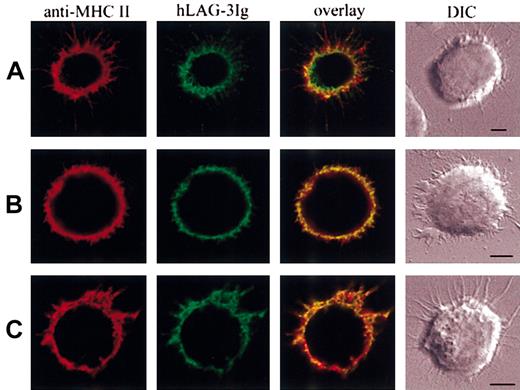 Figure 1. Different binding patterns of LAG-3 and class II-specific mAb on human immature DC. (A,C) Immature DCs were incubated on poly-l-lysine–coated surfaces saturated with PBS–dry milk 3% at 37°C. After 15 minutes of temperature equilibration at 4°C, cells were labeled with LAG-3Ig in green and a class II-specific mAb in red (I3 in panel A, CDw78 in panel C). Bound LAG-3Ig and I3 or CDw78 were revealed using Alexa 488– and Alexa 594–conjugated secondary antibodies, respectively. (B) Cells were pretreated with 10 mM MCD prior to adherence and labeling. Scale bars, 5 μm. DIC indicates differential interferential contrast. The pictures are representative of the results obtained in at least 3 different experiments.