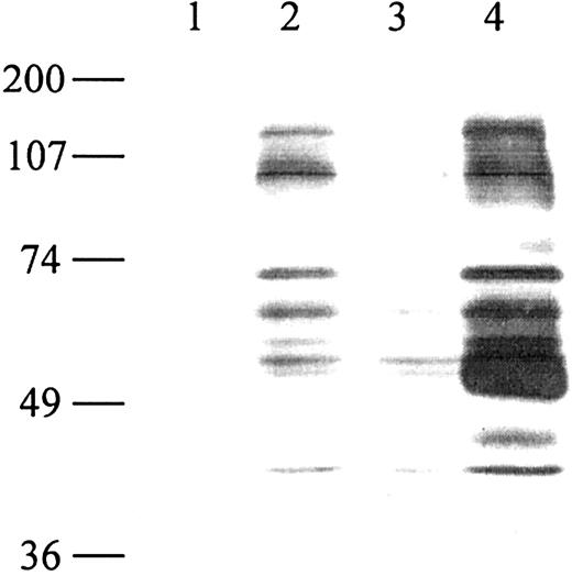 Figure 2. Cross-linking of class II molecules on human dendritic cells induces tyrosine phosphorylation. Monocyte-derived immature DCs (5 × 106) were stimulated at 37°C with medium (lane 1), human LAG-3Ig (lane 2), human IgG1 (lane 3), or I3 (pan class II–specific mAb, lane 4) at 10 μg/mL for 3 minutes followed by cross-linking with a secondary goat antibody directed against human (lanes 2-3) or mouse (lane 4) immunoglobulins at 20 μg/mL for 2 minutes. The cells were lysed, and 75 μg of total cell lysate was loaded per well. Tyrosine phosphorylation of proteins was detected by Western blotting with an antibody specific for phosphotyrosine (anti-pTyr 4G10). The positions of the molecular weight markers are indicated. Lane 1 shows the unstimulated control. Results are representative of 6 experiments performed on different DC samples.