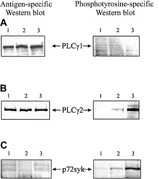 Figure 3. Cross-linking of MHC class II molecules on human dendritic cells induces phosphorylation of the PLCγ2 and p72syk but not PLCγ1. (A) PLCγ1. (B) PLCγ2. (C) p72syk. After stimulation as described in the legend to Figure 2, DC lysates were precleared for 2 hours and immunoprecipitated by incubation with specific antibody at 10 μg/mL. Tyrosine phosphorylation was analyzed by Western blotting of heat-denatured immunoprecipitates with an antibody specific for phosphotyrosine (4G10). Each membrane was rehybridized with antigen-specific antibody to ensure equal loading. IgG1 (lane 1), human LAG-3Ig (lane 2), I3 (pan class II–specific mAb, lane 3). Results are representative of 3 experiments performed on different DC samples.