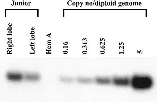 Figure 4. Detection of AAV-cFVIII-SQ transgene in dog liver. DNA was extracted 8 months after injection from the right and left liver lobes of the dog injected with 2.7 × 1013 vg/kg (Junior). Ten μg of DNA was digested with BamHI, Southern blotted, and hybridized with a 32P random-primer–labeled canine FVIII probe. Copy number standards were generated by spiking BamHI-digested naive canine Hem A liver DNA with BamHI-digested cF8104 plasmid DNA at ratios of 5, 1.25, 0.625, 0.313, and 0.16 copies/diploid genome.