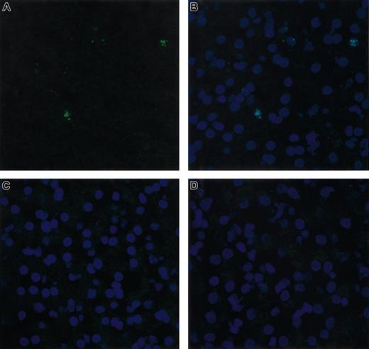 Figure 5. FISH analysis of cFVIII RNA in dog liver. RNA in situ hybridization was performed on liver sections biopsied from Junior 8 months after injection of AAV-cFVIII-SQ at a dose of 2.7 × 1013 vg/kg. The RNA signal (green staining) was detected using a cFVIII antisense probe cocktail (A). Counter-staining (blue staining) of the same section with 4′, 6-diamidino-2-phenlindole is shown (B). No signal was detected when the sections were pretreated with RNase (data not shown), when a cFVIII sense probe was used (C), or when a naive Hem A liver was analyzed (D). Cells were analyzed under a × 40 objective by confocal microscopy.