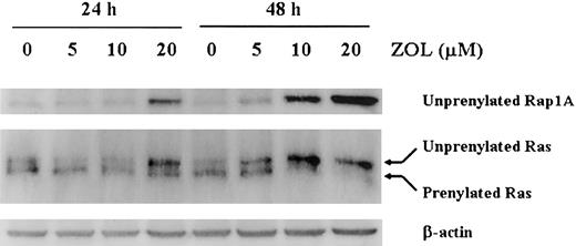 Figure 2. ZOL prevents the prenylation of Rap. Cell lysates from BV173 cells treated with 5, 10, or 20 μM ZOL for 24 and 48 hours were subjected to Western blotting using an antibody specific for the unprenylated form of Rap1A, an antibody for Ras, and for β-actin. The data shown are representative of 3 independent experiments.