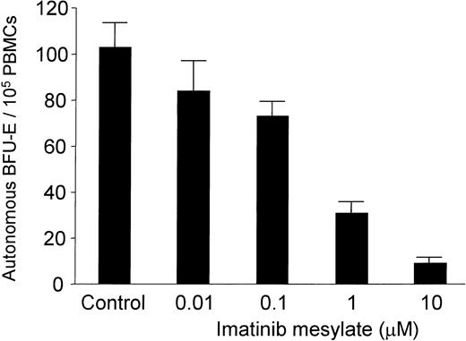 Figure 1. Dose-dependent effect of imatinib mesylate on autonomous BFU-E formation. PB mononuclear cells (MNCs) (1 × 105/mL) from 4 patients with PV were cultured in semisolid medium together with graded amounts of imatinib mesylate (0.01 to 10 μM) in the absence of exogenous growth factors. Autonomous BFU-E formation was assessed after a culture period of 14 days. The mean BFU-E numbers of triplicates (+ standard deviation) are given from 1 representative experiment (patient M).
