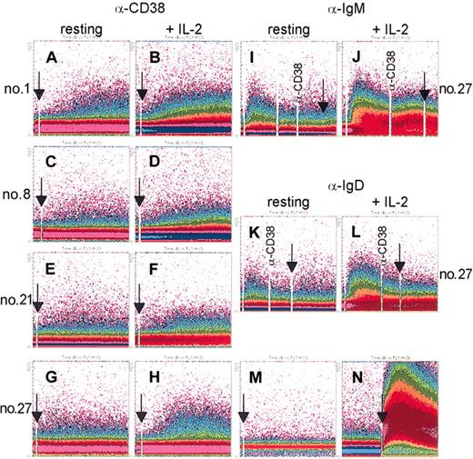Figure 1. mAb ligation of CD38 induces Ca2+ waves in purified B-CLL cells. B-CLL cells purified from patients 1, 8, 21, and 27 were loaded with the fluorescent indicator Fluo 3-am and preincubated (10 minutes at room temperature) with an agonistic anti-CD38 mAb (A,C,E,G). The cells were then washed and analyzed continuously at 37°C using a FACSort, while a RαMIg was added as cross-linker (arrows) 10 seconds after starting the analysis. IgM and IgD ligation using specific polyclonal antibodies induced Ca2+ responses, as expected, whereas no synergy was observed when adding the anti-CD38 mAb (I,K). The same cells were cultured for 3 days in the presence of 100 IU/mL IL-2 and re-evaluated for Ca2+ mobilization on CD38 cross-linking (B,D,F,H), as well as for IgM (J) and IgD (L). A nonagonistic anti-CD38 mAb was unable to mobilize Ca2+ ions (M). Appropriate dye loading by the cells was checked by the addition of the ionophore A23187 (N, arrow). Data are presented as density plot of the shift in the Fluo 3-am fluorescence (y-axis) over a 512-second period (x-axis).