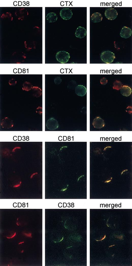 Figure 5. CD38 is recruited in the membrane rafts on mAb binding. B cells purified from 8 different CD38+ CLL patients were cultured for 3 days in the presence of 100 IU/mL IL-2 to increase CD38 expression. The experiments were performed as described in Figures 3 and 4. The mAb ligation drives CD38 to the membrane microdomains, as witnessed by the presence of GM1 ganglioside (stained by CTX-FITC) in the CD38 patches. Further, capping of the CD38 molecules induces cocapping of CD81 (a microdomain resident molecule), but not of HLA class I. Original magnification × 60.