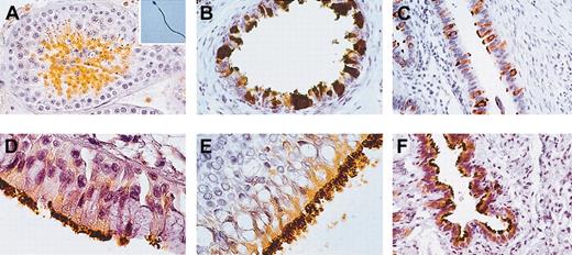 Figure 1. Immunohistochemistry for HSp17 in human testis, ejaculated spermatozoa, and paradigmatic human ciliated epithelial cells. (A) Histologic section of healthy testis. HSp17 was found in spermatocytes and abundantly in spermatids, while spermatogonia and Sertoli cells were found to be immunonegative. Hsp17 was strongly found throughout the principal piece of the flagellum in a large amount of fertile ejaculated spermatozoa (inset). (B) Histologic section of ductuli efferenti of the male germinal tract, (C) tubes of the female genital tract, (D) trachea, (E) larynx, and (F) lung. (B-F) HSp17 was expressed in the cytoplasm of lining ciliated epithelial cells and their cilia. Original magnification × 400 for panels A-C and F; × 1000 for panels D, E, and inset. Indirect immunoperoxidase staining was used.